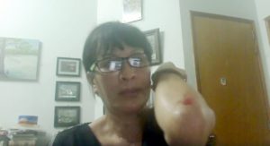 Vụ cô Sương Quỳnh bị đánh: tính chính danh của chính quyền ở đâu? Vụ cô Sương Quỳnh bị đánh: tính chính danh của chính quyền ở đâu?
