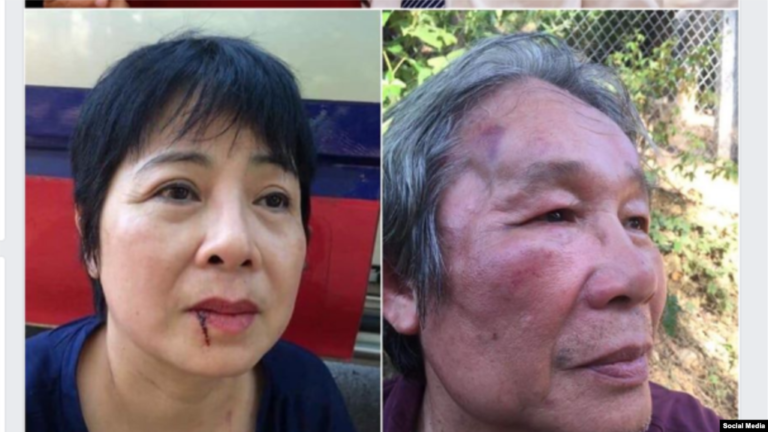 Thân nhân bị hành hung khi đi thăm tù nhân lương tâm ở trại 6 Nghệ An Thân nhân bị hành hung khi đi thăm tù nhân lương tâm ở trại 6 Nghệ An