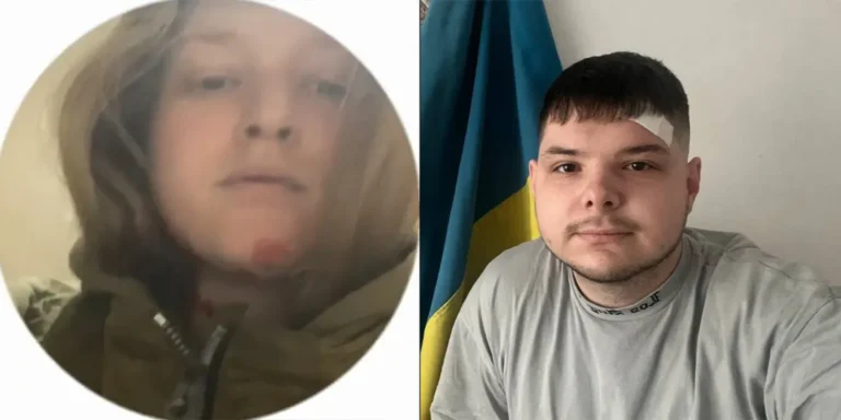 Ít nhất 3 nhà báo bị thương trong vụ tấn công tên lửa ở Ukraine