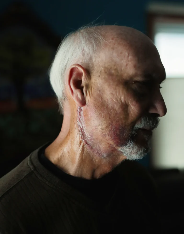 Gãy xương, mắt cay xè: Bộ An ninh Nội địa của Trump sử dụng vũ khí “ít gây sát thương” đối với người biểu tình như thế nào